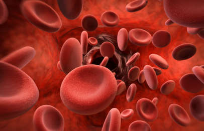 Haematology